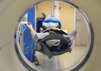 La thérapie de médecine nucléaire
