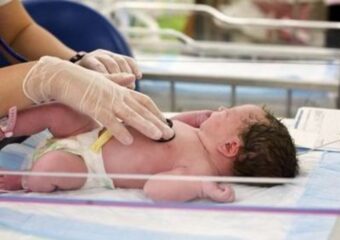 Défaut septal auriculaire (TSA) : de quoi s'agit-il