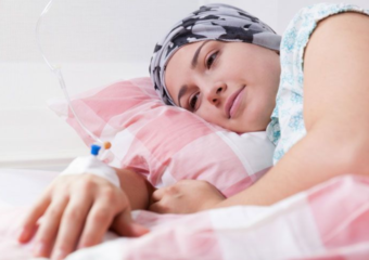 Idées reçues sur la chimiothérapie