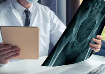 Traitement du cancer des os