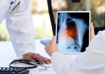 La chirurgie pour soigner le cancer des poumons