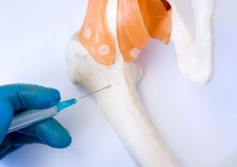 Greffe de la moelle osseuse : le cas pédiatrique (Pediatric Bone Marrow Transplant)