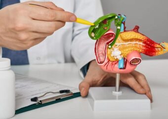 Tout savoir sur le cancer du pancréas